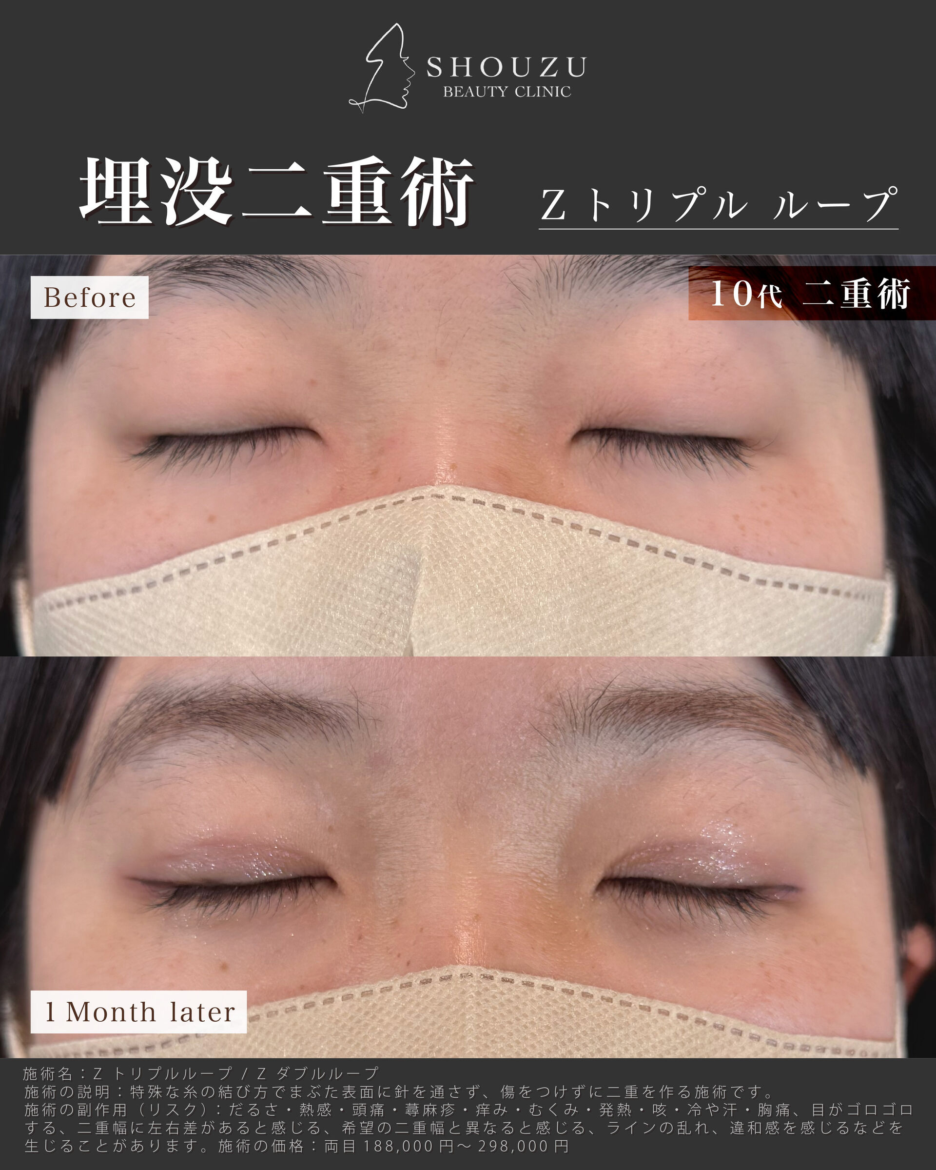 こちらは10代 女性モニターのお客様です