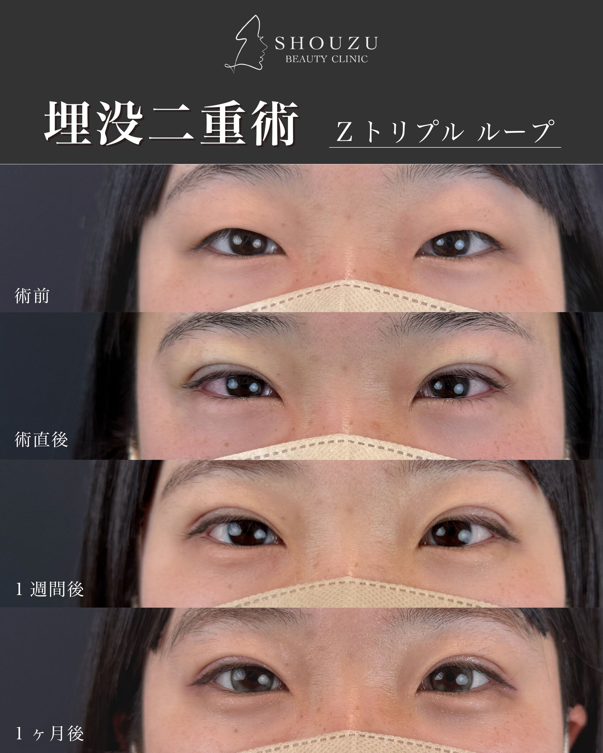 こちらは10代 女性モニターのお客様です