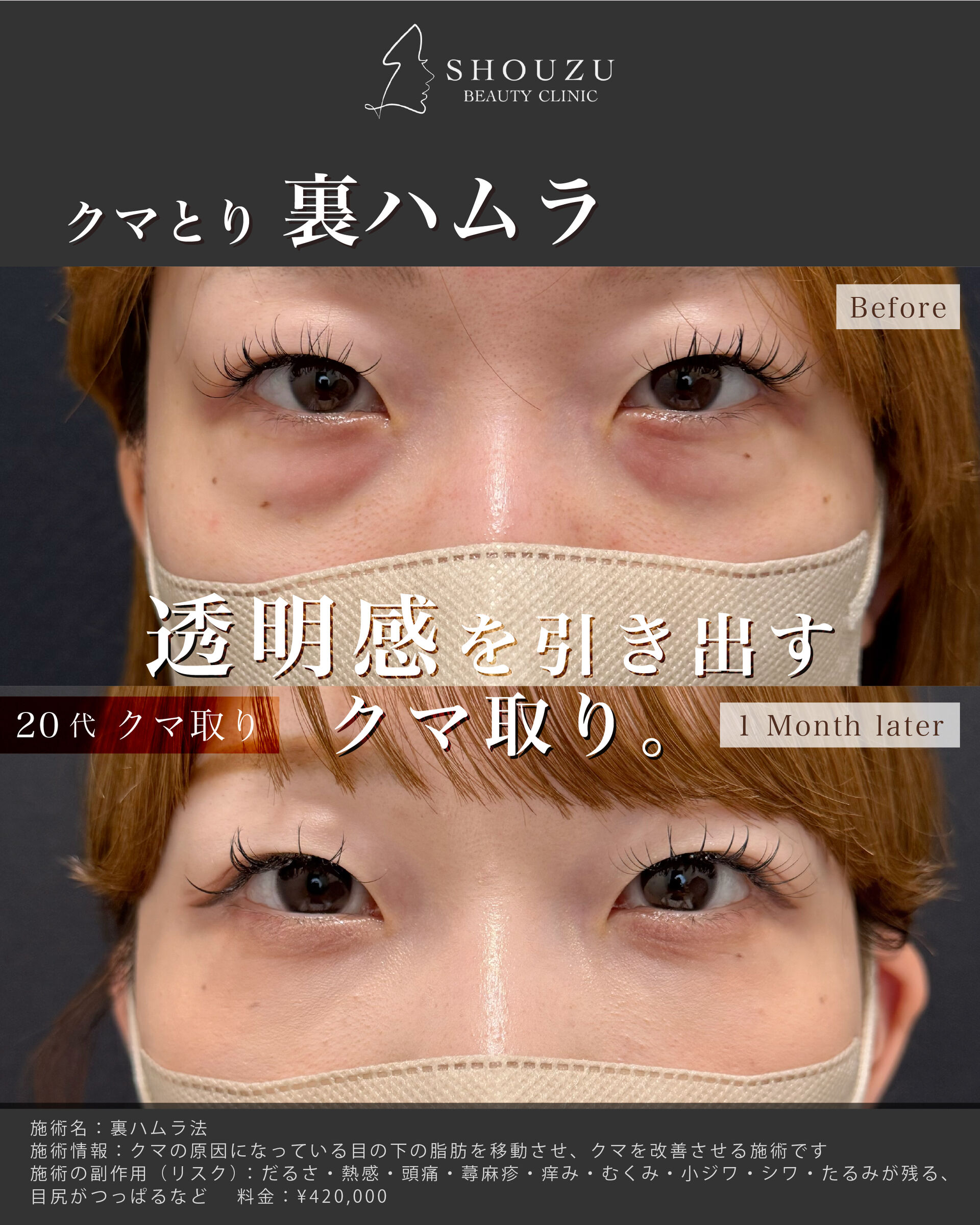 女性 20代モニターのお客様です