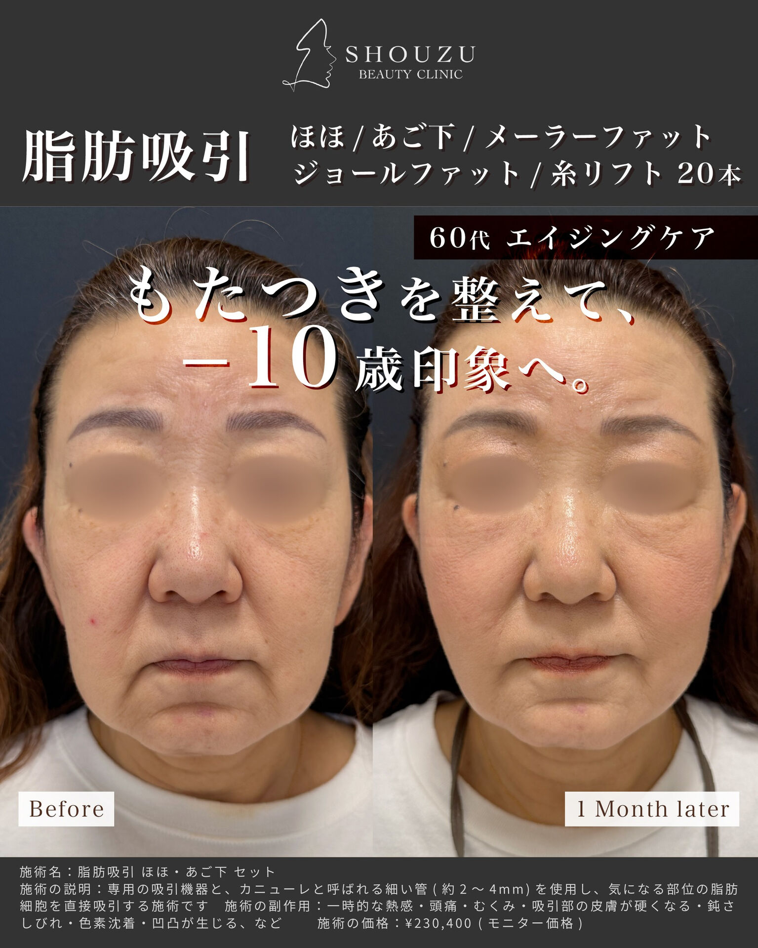 こちらは60代 女性モニターのお客様です