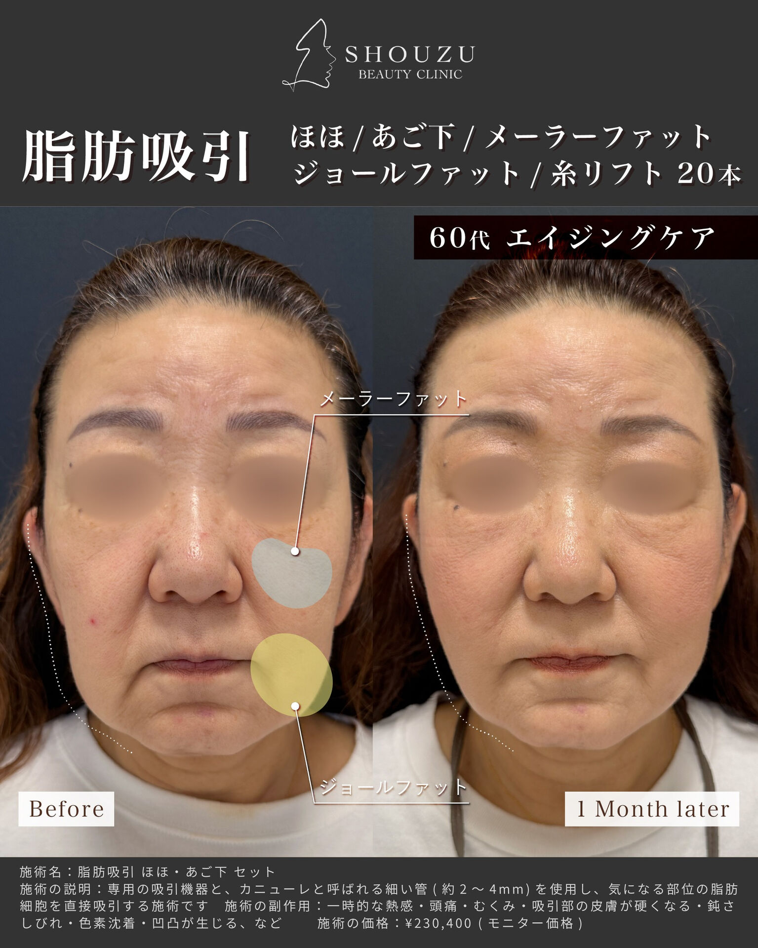 こちらは60代 女性モニターのお客様です