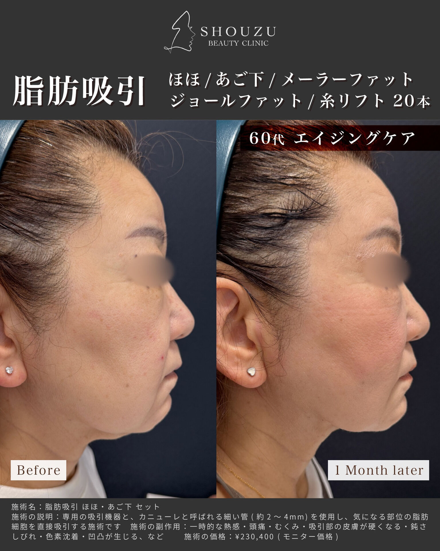 こちらは60代 女性モニターのお客様です