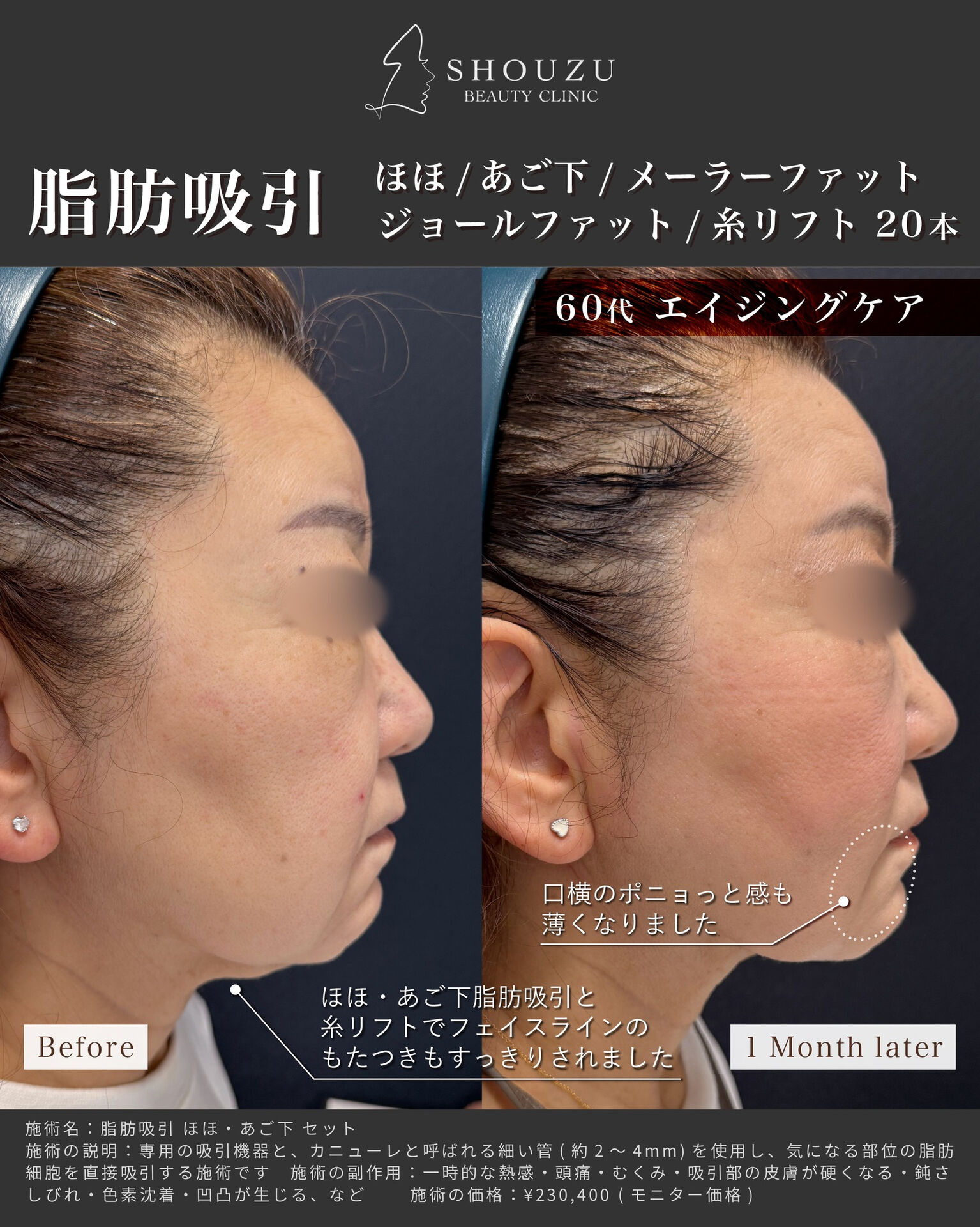 こちらは60代 女性モニターのお客様です