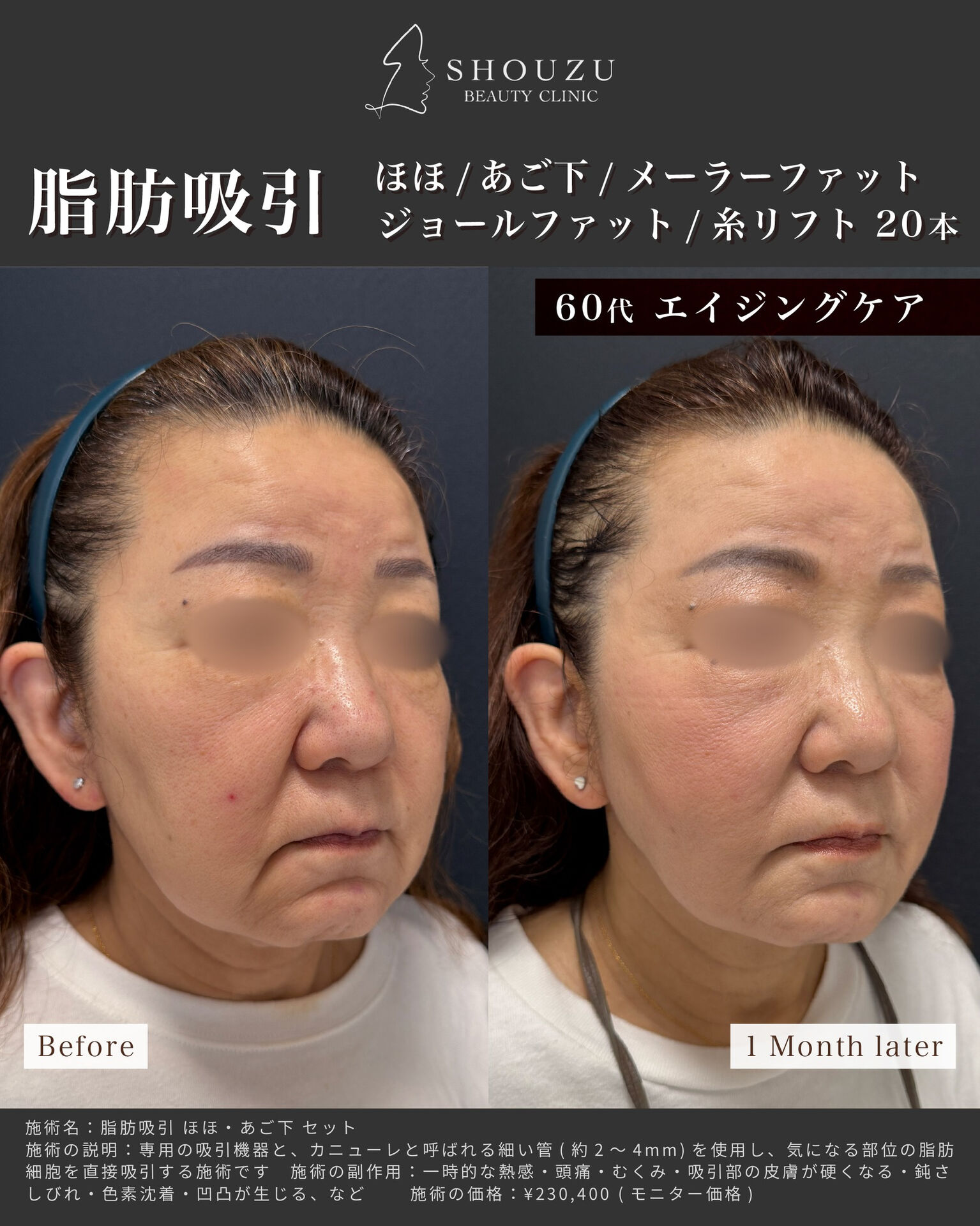 こちらは60代 女性モニターのお客様です