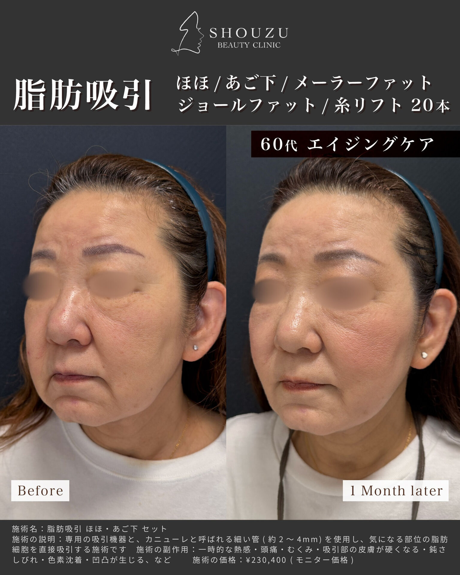 こちらは60代 女性モニターのお客様です