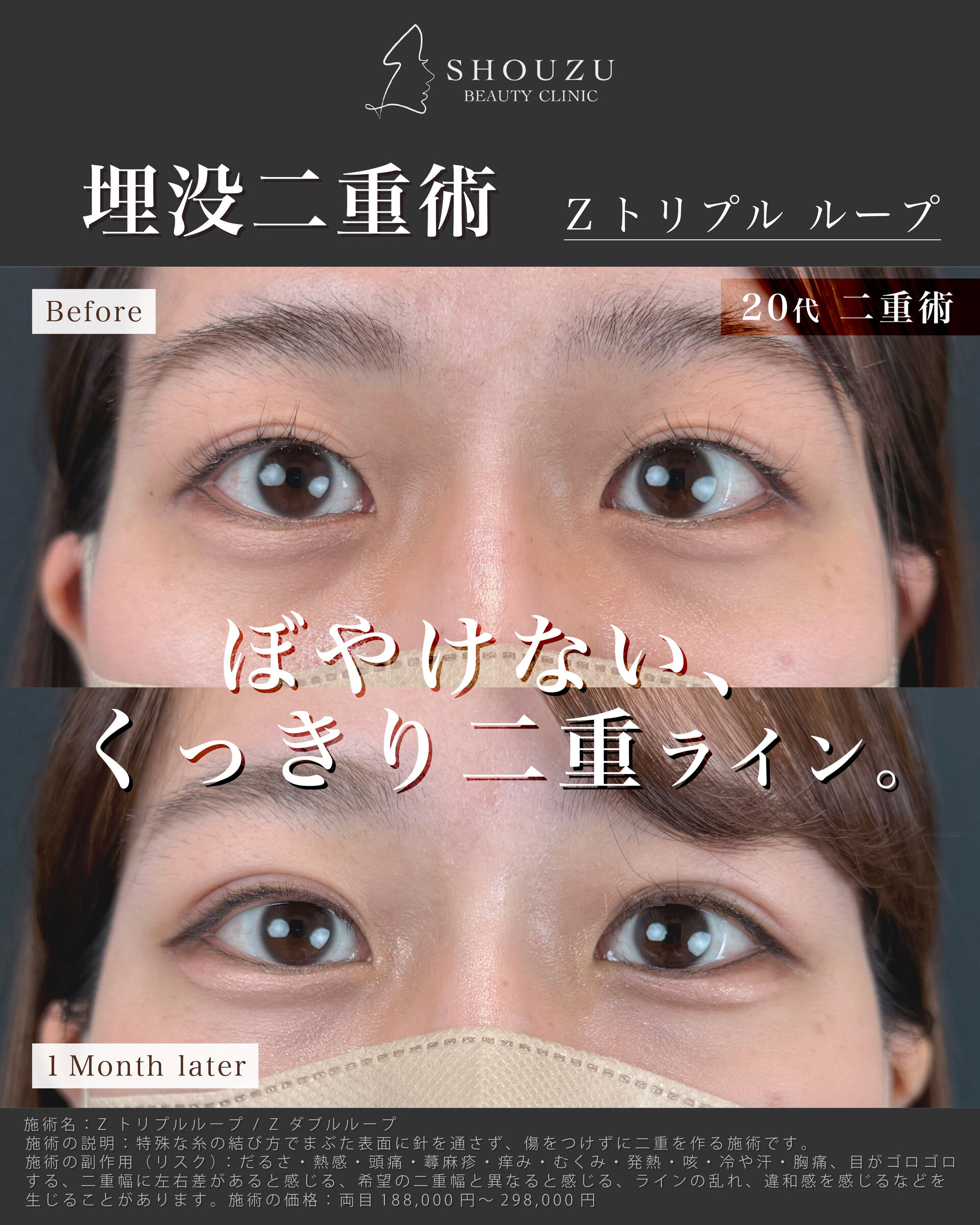 こちらは20代 女性モニターのお客様です