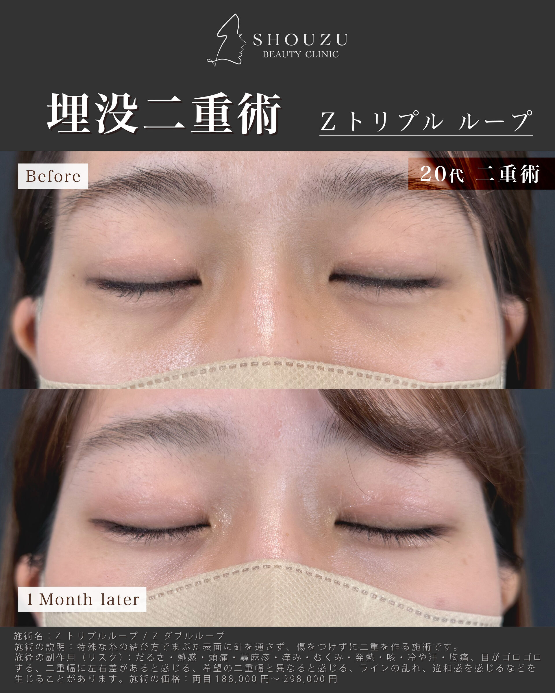 こちらは20代 女性モニターのお客様です
