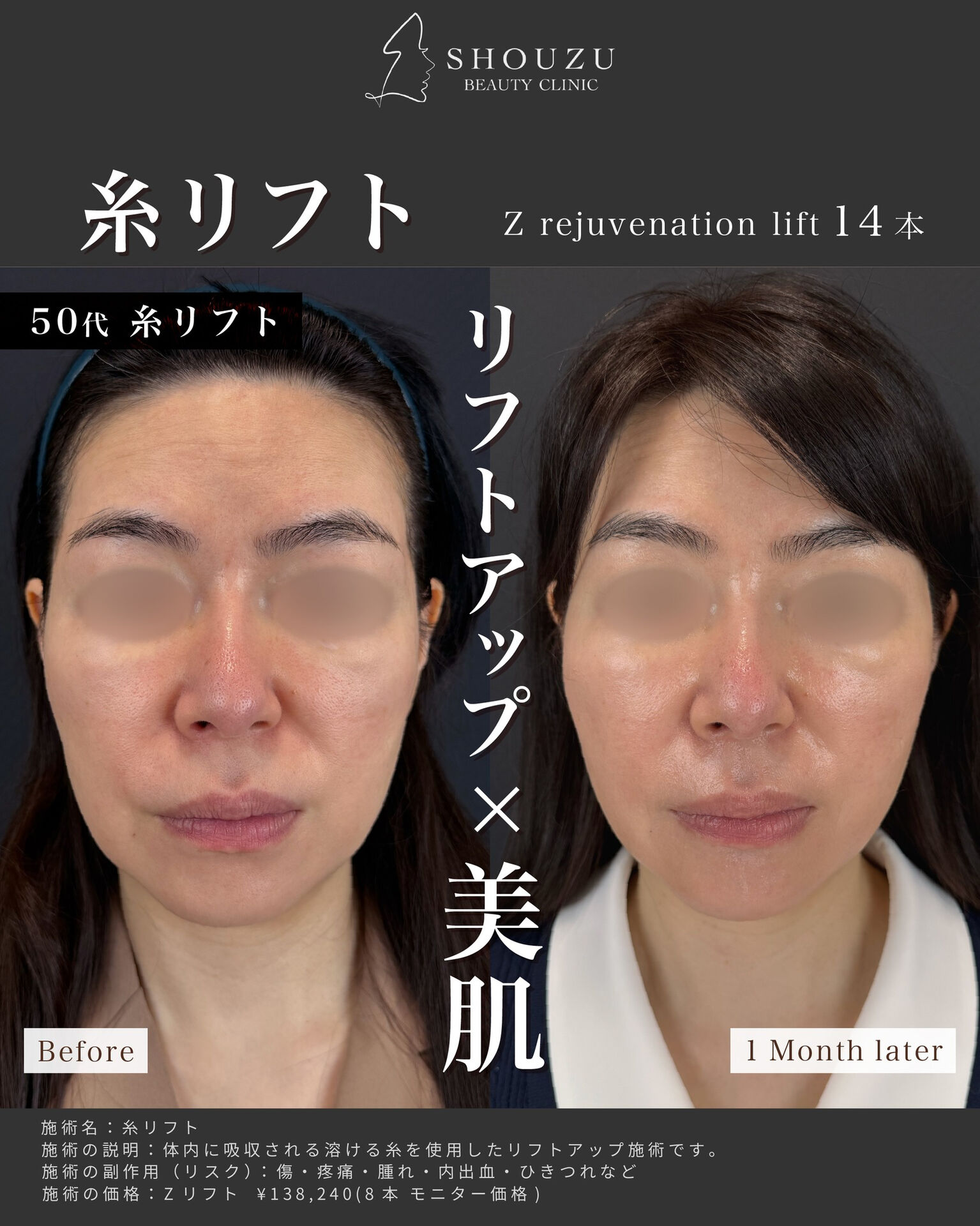 こちらは50代 女性モニターのお客様です