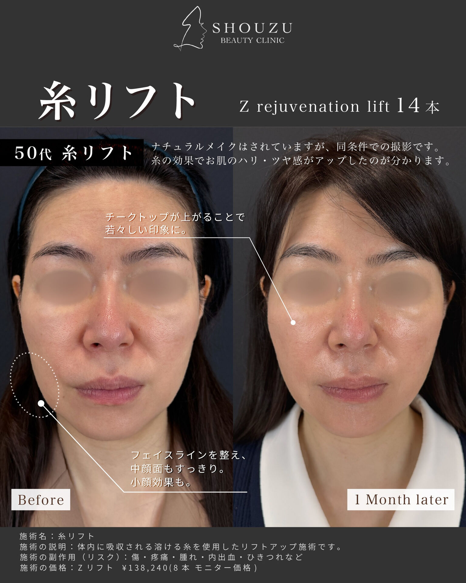 こちらは50代 女性モニターのお客様です