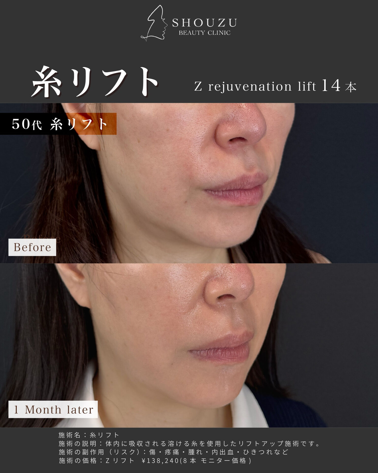こちらは50代 女性モニターのお客様です
